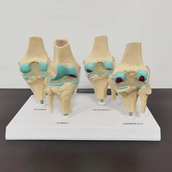 4-ступенчатая модель коленного сустава Пластиковая Модель Кости Человеческого Тела Учебное Оборудование Студенческая Лаборатория Медицинская Учебная Модель ПВХ Модель