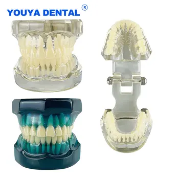 Стоматологическое стандартное обучение модели зубов Typodont Для студентов-стоматологов, инструмент для демонстрации стоматологического оборудования для десневой челюсти